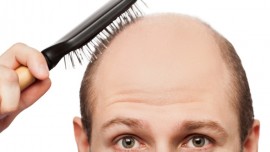 causas-da-queda-de-cabelos-transplante-capilar