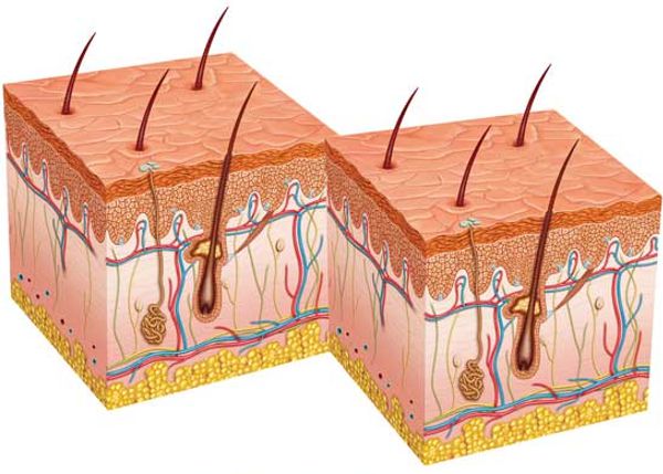 o que são foliculos capilares transplante de cabelo